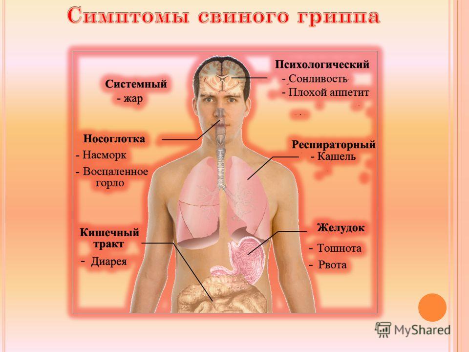 Что за грипп сейчас ходит. Симптомы св нного гриппа. Свиной грипп симптомы. Симптомы свинрго группа. Симптомы свиноготгриппа.