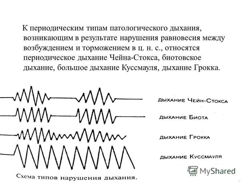 Графическое изображение дыхания