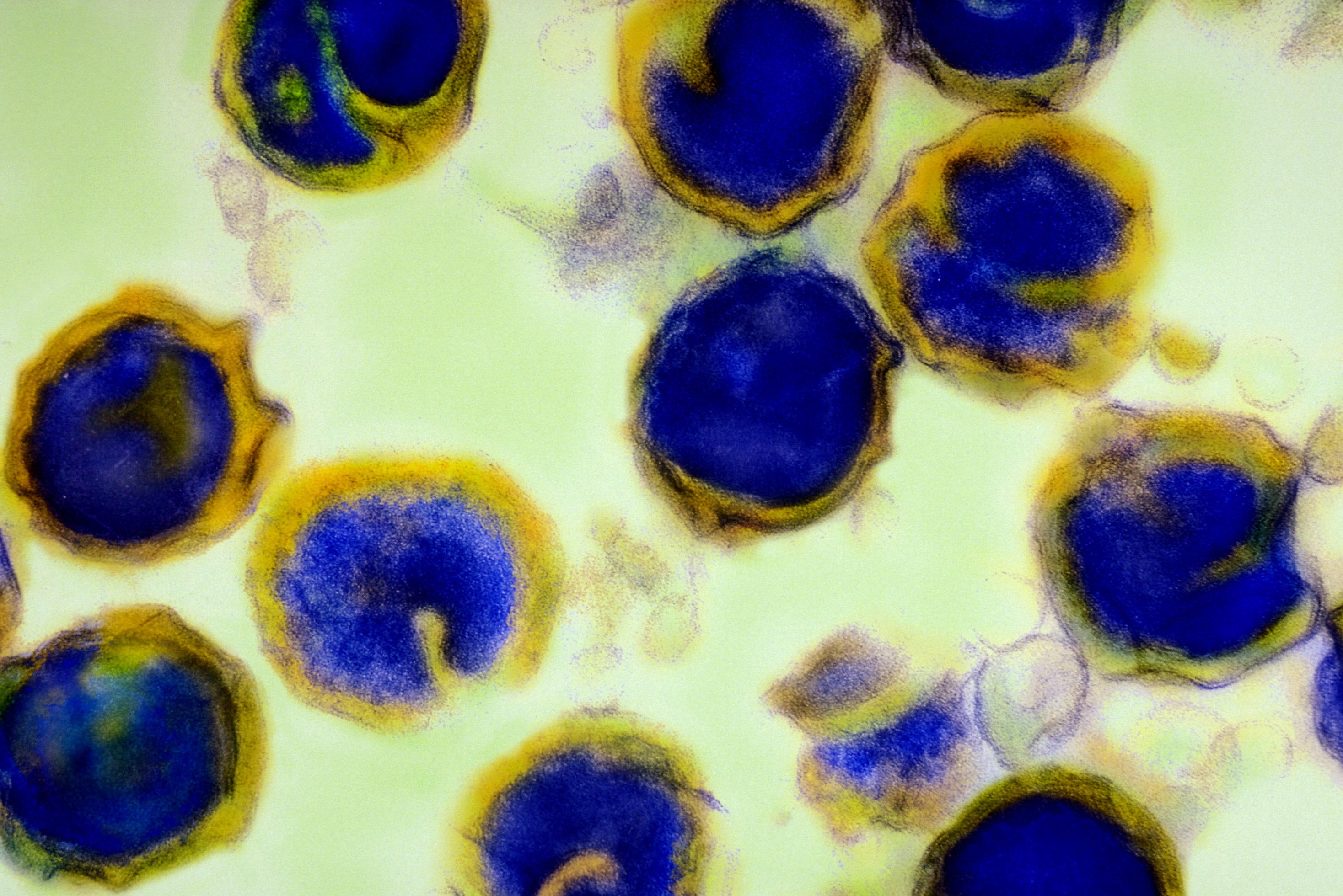 Хламидия 5. Бактерия хламидия трахоматис. Респираторный хламидиоз под микроскопом.
