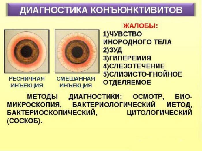 Глазные антибиотики капли список