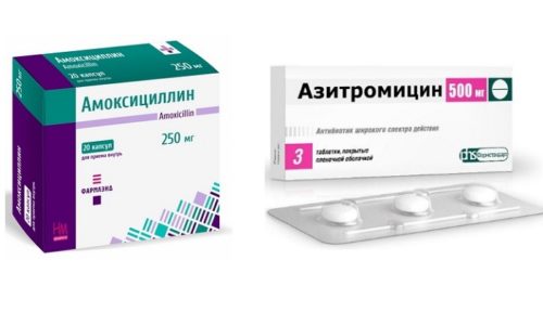 Наиболее популярными антибактериальными лекарствами при лечении бронхита являются: Азитромицин, Амоксициллин