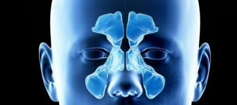 Рентген носовых пазух здорового человека