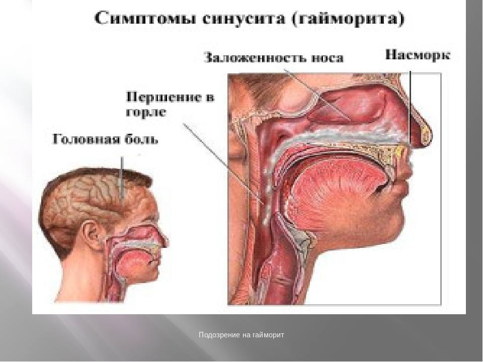 Сильно заложен нос