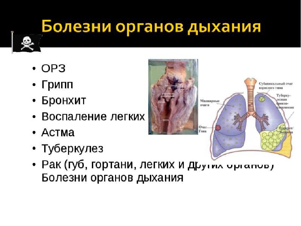 Легкие доклад 3 класс. Заболевания органов дыхания. Болезни дыхательных органов. Заболевания органов дыхательной системы. Презентация на тему заболевания органов дыхания.