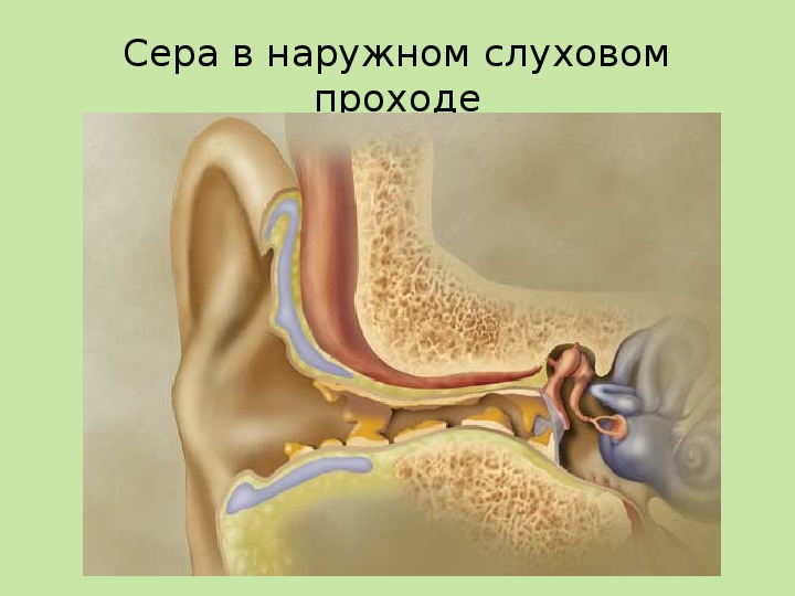 Хлюпает вода в ухе. Ушная сера в барабанной перепонке. Анатомия уха серная пробка. Строение человеческого уха серная пробка. Серная пробка наружного слухового прохода.