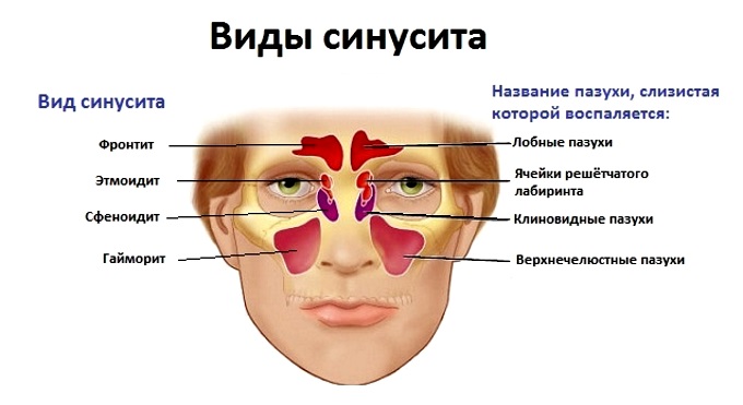 По какой причине появляются желтые сопли