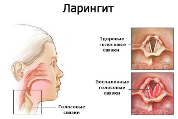 Доктор Мом мазь. Инструкция по применению для детей при кашле, насморке, женщинам при беременности, состав, аналоги, цена