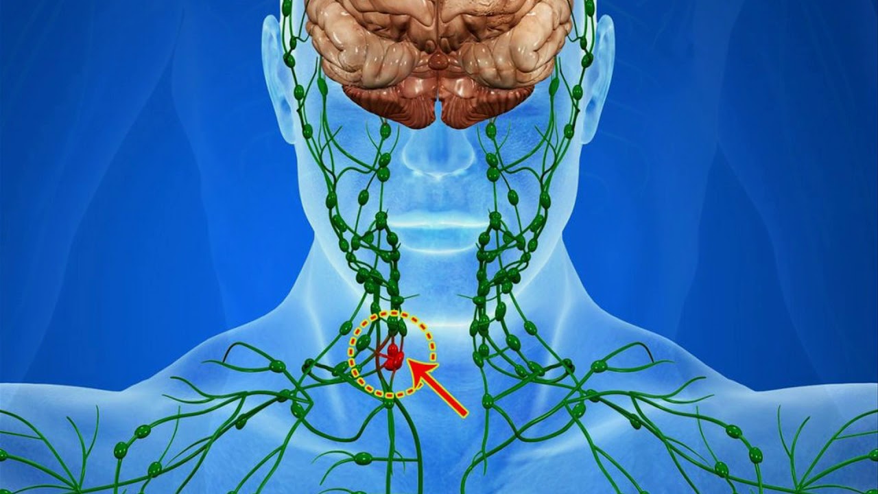 Система лимфоузлов человека. Лимфатические узлы фото.