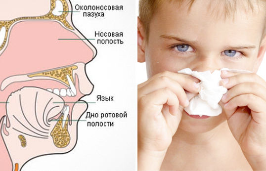 Откуда появляется сопля в носу. Аллергический ринит слизь из носа. Слизистая при насморке.