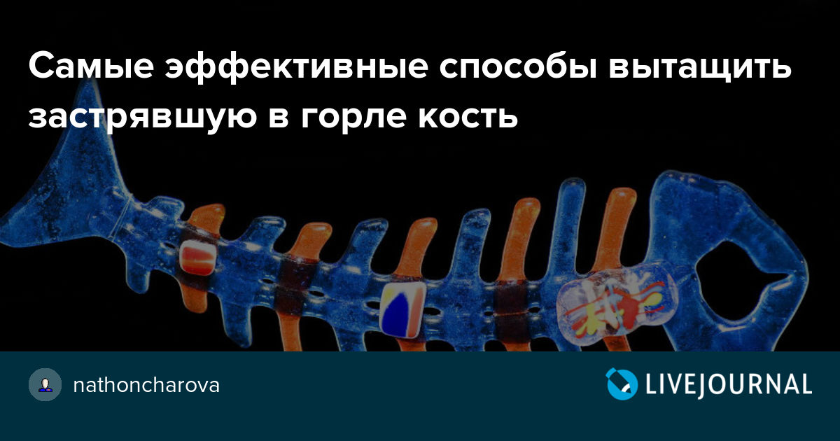 Рыба в горле. Застряла косточка в горле. Застряла косточка от рыбы в горле. Рыбная косточка застряла в горле. Кость рыбы застряла в горле.