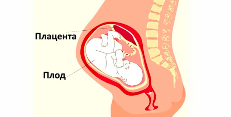 Чем можно лечить горло при беременности в 1 триместре?