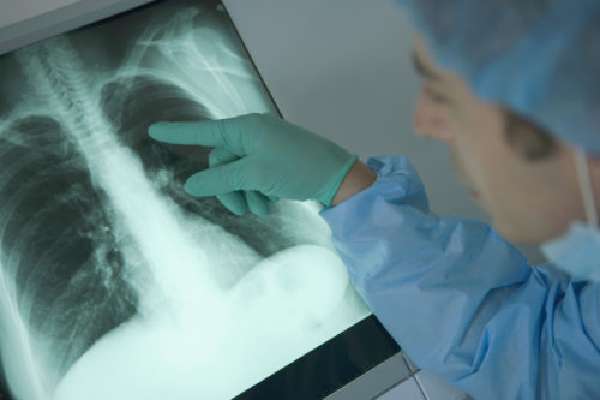 Многие осложнения можно обнаружить с помощью проведения рентгена