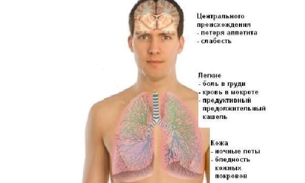 Характеристика инфильтративного туберкулеза