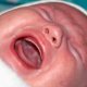 Белый язык у новорожденного: есть ли повод для беспокойства