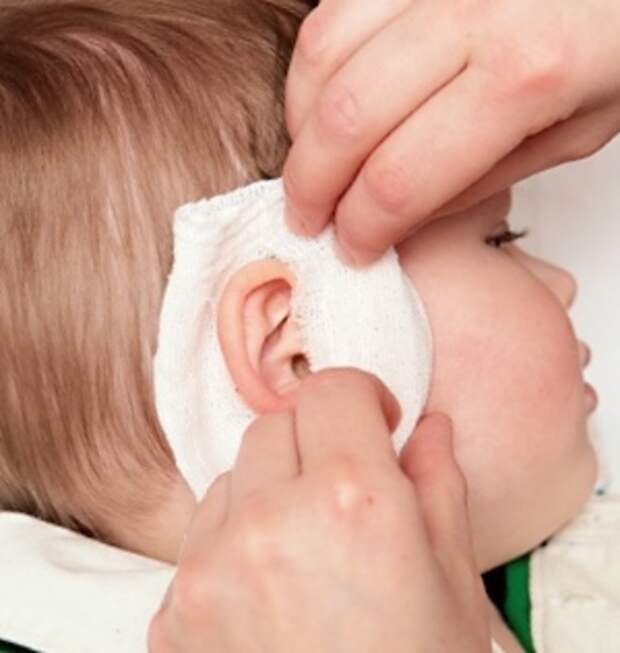 Чем можно закапывать уши ребенку. Ушной компресс на ухо ребенку.