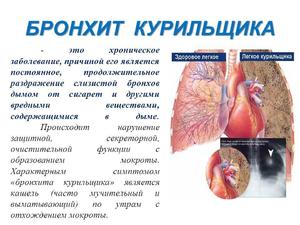 Кашель курильщика - симптомы и лечение 