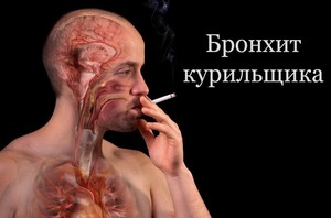 Бронхит курильщика: симптомы