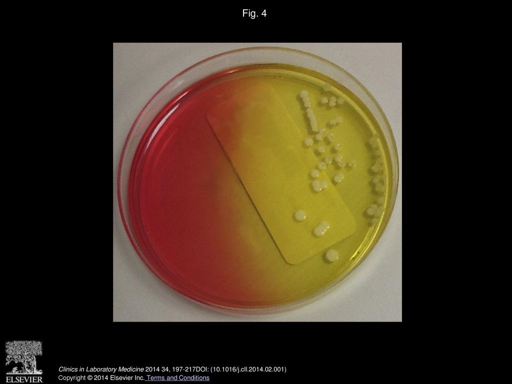 Staphylococcus aureus 10 4. Стафилококк aureus в моче. Staphylococcus haemolyticus в моче. Стафилококки и стрептококки в моче. Микроорганизм в моче Staphylococcus epidermidis.