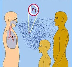 Как передается пневмония от человека к человеку