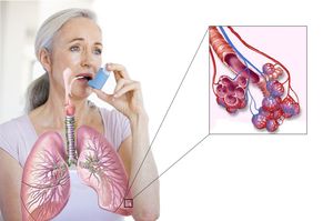 Причины постоянной мокроты в горле без кашля причины и лечение
