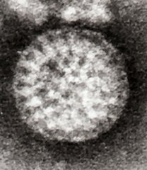 Микрофотография наверху изображает заражённую клетку с разрушенной мембраной, внизу — здоровую клетку.