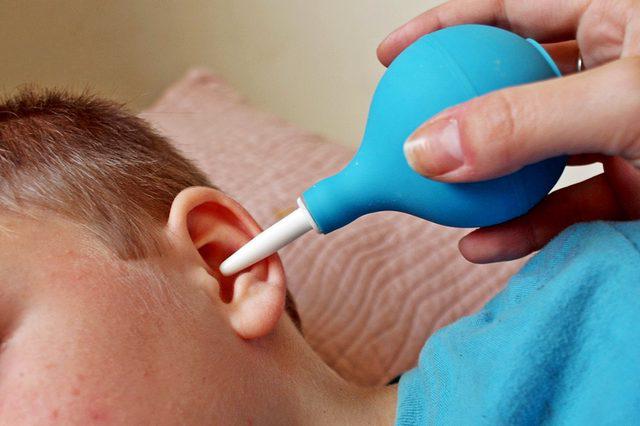как промыть уши перекисью водорода
